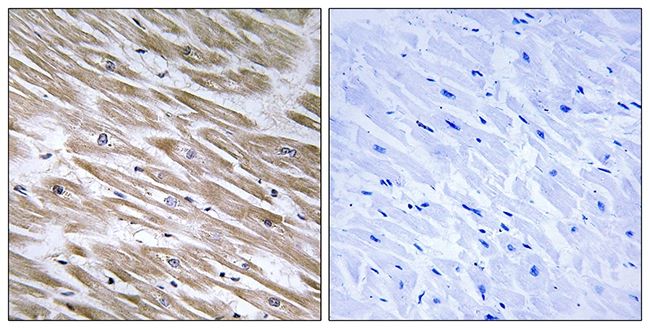 IHC-P analysis of human heart tissue using GTX87782 KANK2 antibody. The picture on the right is blocked with the synthesized peptide.