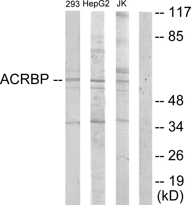 WB analysis of HepG2, Jurkat, and 293 cell lysates using GTX87784 ACRBP antibody. The lane on the right is blocked with the synthesized peptide. WB analysis of HepG2, Jurkat, and 293 cell lysates using GTX87784 ACRBP antibody. The lane on the right is blocked with the synthesized peptide.