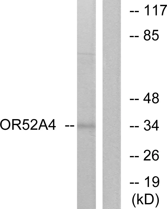 WB analysis of MCF-7 cell lysates using GTX87794 OR52A4 antibody. The lane on the right is blocked with the synthesized peptide. WB analysis of MCF-7 cell lysates using GTX87794 OR52A4 antibody. The lane on the right is blocked with the synthesized peptide.