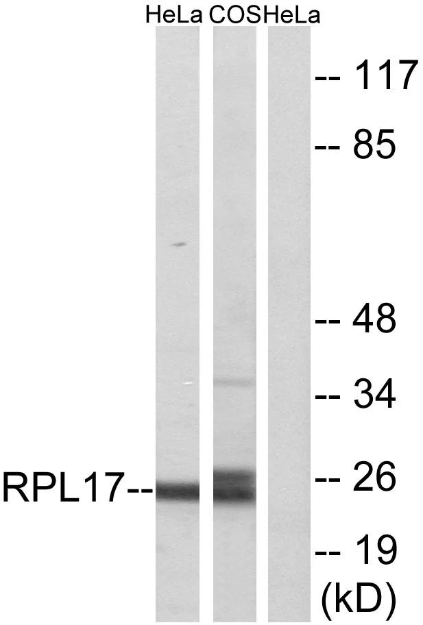 WB analysis of HeLa and COS7 cell lysates using GTX87817 RPL17 antibody. The lane on the right is blocked with the synthesized peptide.
