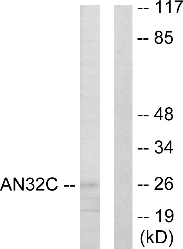 WB analysis of HUVEC cell lysates using GTX87819 ANP32C antibody. The lane on the right is blocked with the synthesized peptide. WB analysis of HUVEC cell lysates using GTX87819 ANP32C antibody. The lane on the right is blocked with the synthesized peptide.