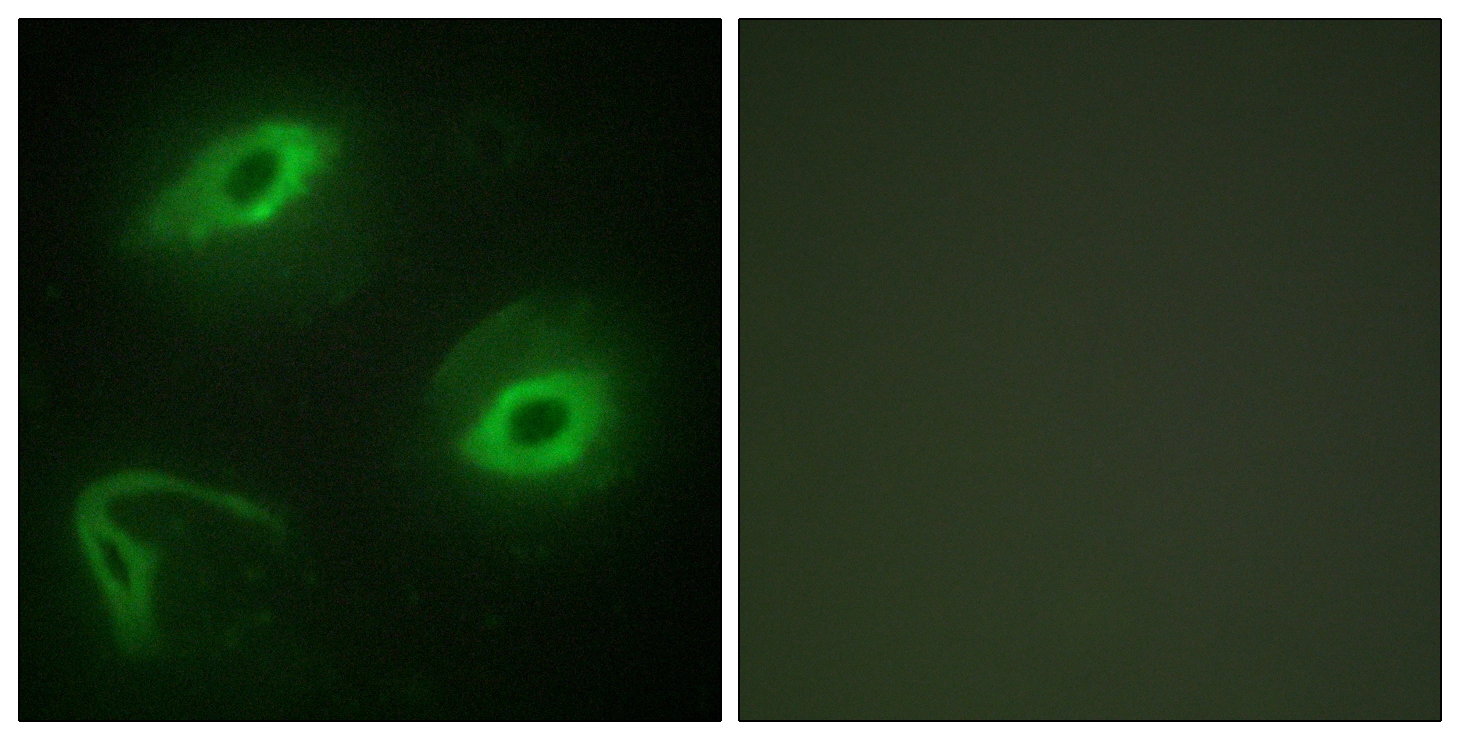 ICC/IF analysis of HeLa cells using GTX87824 LATH antibody. The picture on the right is blocked with the synthesized peptide. ICC/IF analysis of HeLa cells using GTX87824 LATH antibody. The picture on the right is blocked with the synthesized peptide.