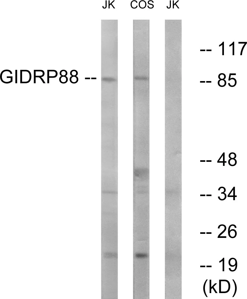 WB analysis of Jurkat and COS cell lysates using GTX87836 GIDRP88 antibody. The lane on the right is blocked with the synthesized peptide.