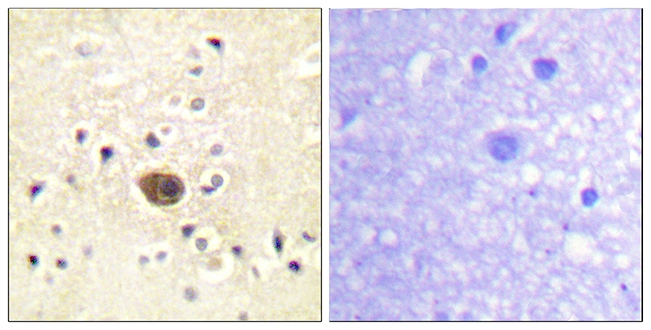 IHC-P analysis of human brain tissue using GTX87849 RASGRF1 antibody. The picture on the right is blocked with the synthesized peptide.