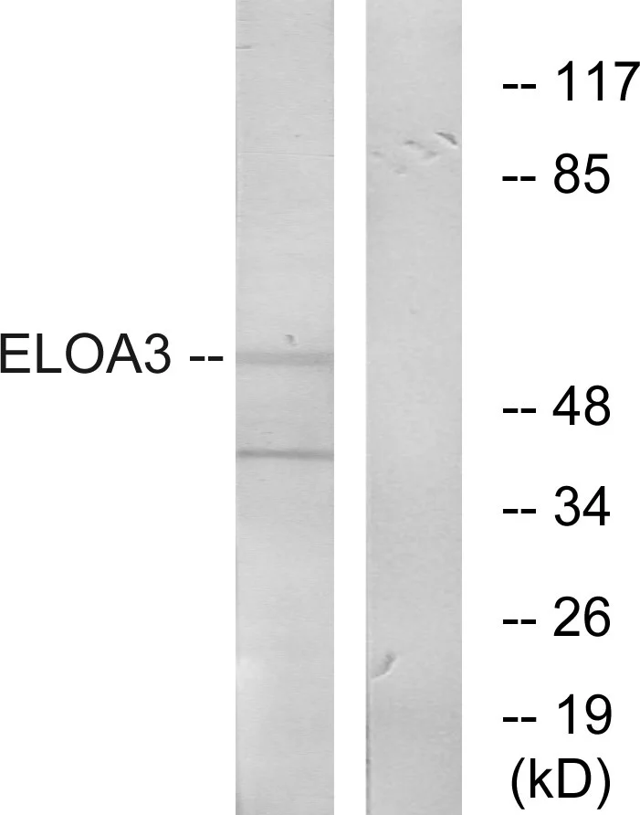 WB analysis of COLO205 cell lysates using GTX87851 ELOA3 antibody. The lane on the right is blocked with the synthesized peptide. WB analysis of COLO205 cell lysates using GTX87851 ELOA3 antibody. The lane on the right is blocked with the synthesized peptide.