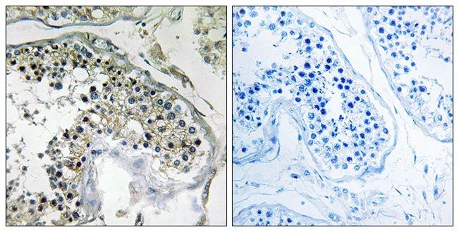 IHC-P analysis of human testis tissue using GTX87861 PPP1R1C antibody. The picture on the right is blocked with the synthesized peptide.