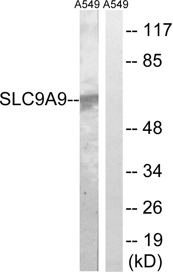 WB analysis of A549 cell lysates using GTX87863 SLC9A9 antibody. The lane on the right is blocked with the synthesized peptide. WB analysis of A549 cell lysates using GTX87863 SLC9A9 antibody. The lane on the right is blocked with the synthesized peptide.