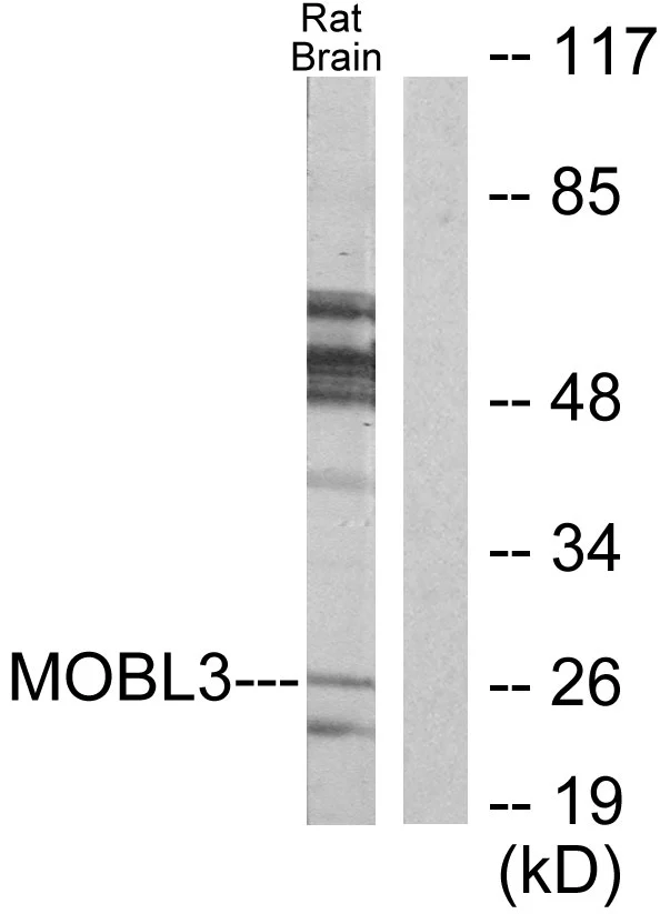 WB analysis of rat brain cell lysates using GTX87869 MOBKL3 antibody. The lane on the right is blocked with the synthesized peptide. WB analysis of rat brain cell lysates using GTX87869 MOBKL3 antibody. The lane on the right is blocked with the synthesized peptide.