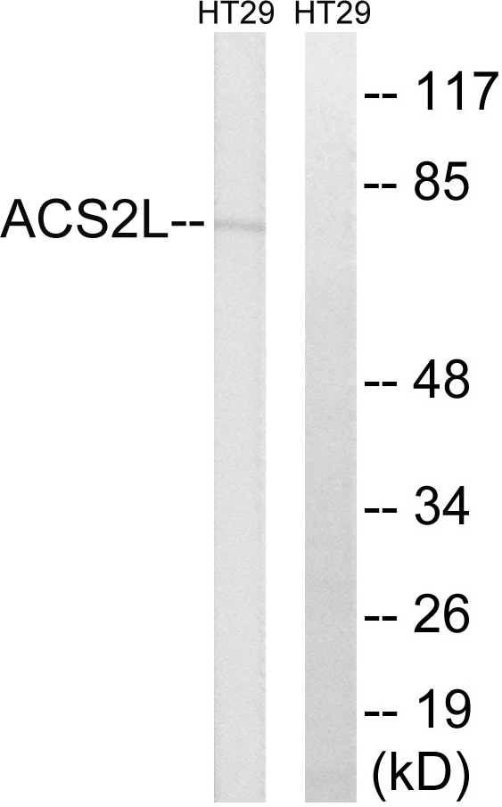 WB analysis of HT-29 cell lysates using GTX87873 ACSS1 antibody. The lane on the right is blocked with the synthesized peptide.