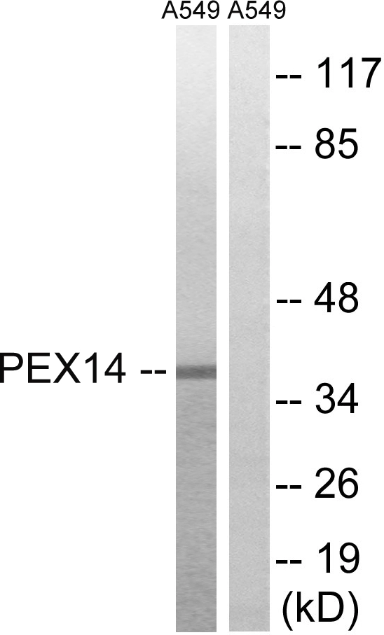 WB analysis of A549 cell lysates using GTX87875 PEX14 antibody. The lane on the right is blocked with the synthesized peptide.