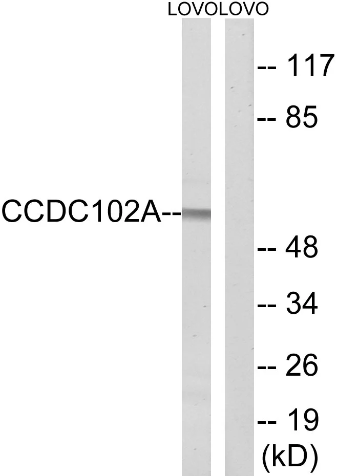 WB analysis of LOVO cell lysates using GTX87877 CCDC102A antibody. The lane on the right is blocked with the synthesized peptide. WB analysis of LOVO cell lysates using GTX87877 CCDC102A antibody. The lane on the right is blocked with the synthesized peptide.