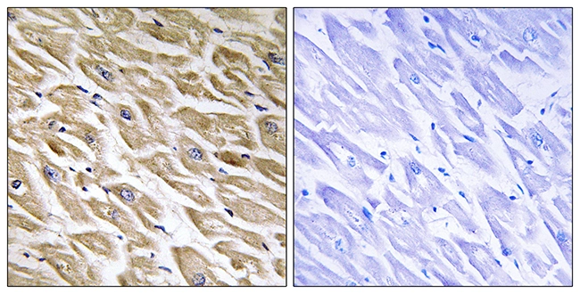IHC-P analysis of human heart tissue using GTX87886 MRPL39 antibody. The picture on the right is blocked with the synthesized peptide. IHC-P analysis of human heart tissue using GTX87886 MRPL39 antibody. The picture on the right is blocked with the synthesized peptide.