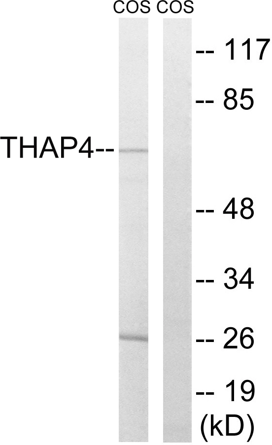 WB analysis of COS7 cell lysates using GTX87897 THAP4 antibody. The lane on the right is blocked with the synthesized peptide. WB analysis of COS7 cell lysates using GTX87897 THAP4 antibody. The lane on the right is blocked with the synthesized peptide.