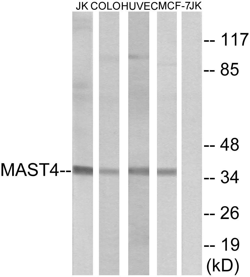 WB analysis of Jurkat,COLO,HUVEC,and MCF-7 cell lysates using GTX87899 MAST4 antibody. The lane on the right is blocked with the synthesized peptide.