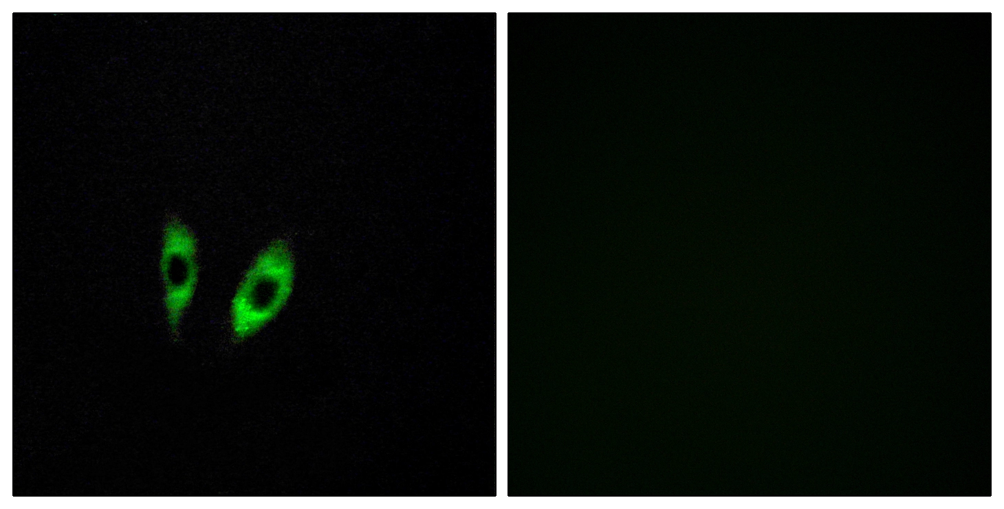 ICC/IF analysis of HeLa cells using GTX87902 GPR156 antibody. The picture on the right is blocked with the synthesized peptide. ICC/IF analysis of HeLa cells using GTX87902 GPR156 antibody. The picture on the right is blocked with the synthesized peptide.