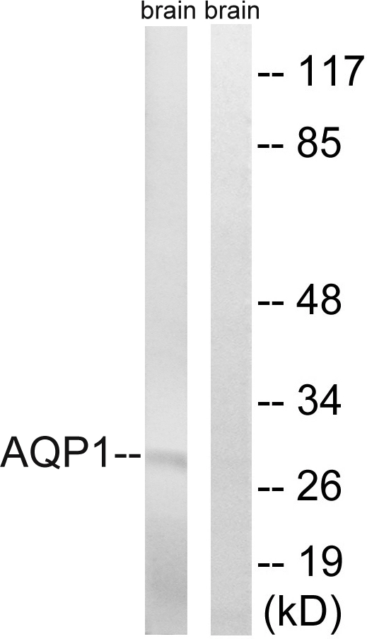 WB analysis of rat brain cell lysates using GTX87904 Aquaporin 1 antibody. The lane on the right is blocked with the synthesized peptide.