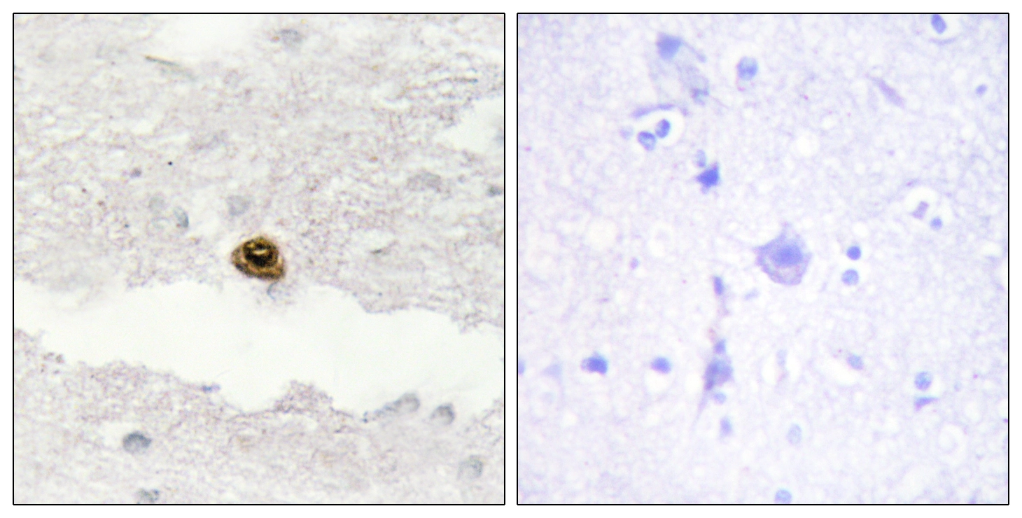 IHC-P analysis of human brain tissue using GTX87908 DGKZ antibody. The picture on the right is blocked with the synthesized peptide. IHC-P analysis of human brain tissue using GTX87908 DGKZ antibody. The picture on the right is blocked with the synthesized peptide.