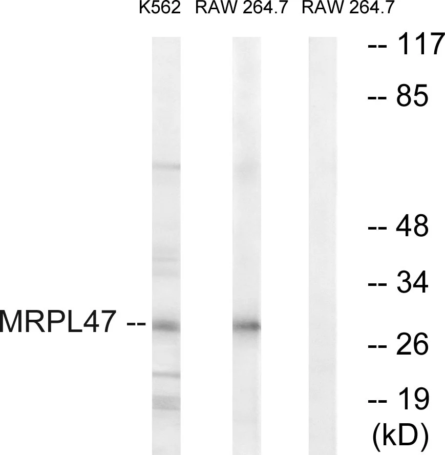 WB analysis of RAW264.7 and K562 cell lysates using GTX87919 MRPL47 antibody. The lane on the right is blocked with the synthesized peptide. WB analysis of RAW264.7 and K562 cell lysates using GTX87919 MRPL47 antibody. The lane on the right is blocked with the synthesized peptide.