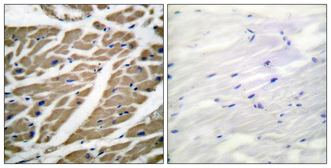 IHC-P analysis of human heart tissue using GTX87930 Sodium Channel-pan antibody. The picture on the right is blocked with the synthesized peptide. IHC-P analysis of human heart tissue using GTX87930 Sodium Channel-pan antibody. The picture on the right is blocked with the synthesized peptide.