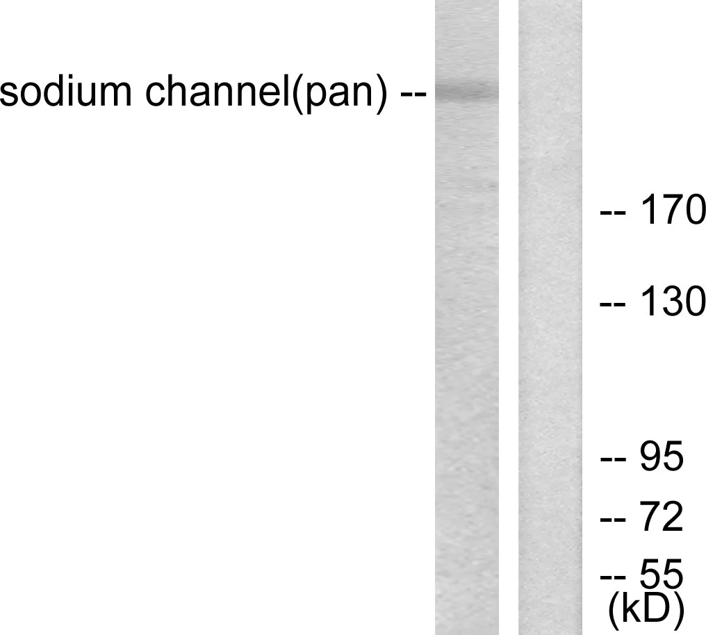 WB analysis of HUVEC cell lysates using GTX87930 Sodium Channel-pan antibody. The lane on the right is blocked with the synthesized peptide.