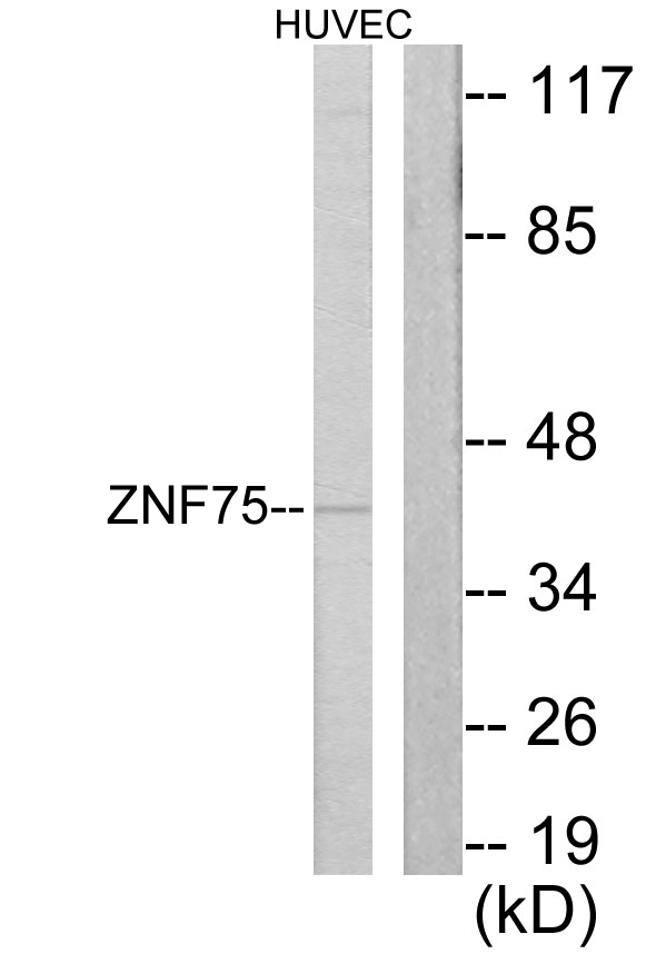 WB analysis of HUVEC cell lysates using GTX87939 ZNF75 antibody. The lane on the right is blocked with the synthesized peptide. WB analysis of HUVEC cell lysates using GTX87939 ZNF75 antibody. The lane on the right is blocked with the synthesized peptide.