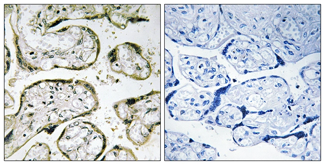 IHC-P analysis of human placenta tissue using GTX87942 MRPL42 antibody. The picture on the right is blocked with the synthesized peptide. IHC-P analysis of human placenta tissue using GTX87942 MRPL42 antibody. The picture on the right is blocked with the synthesized peptide.
