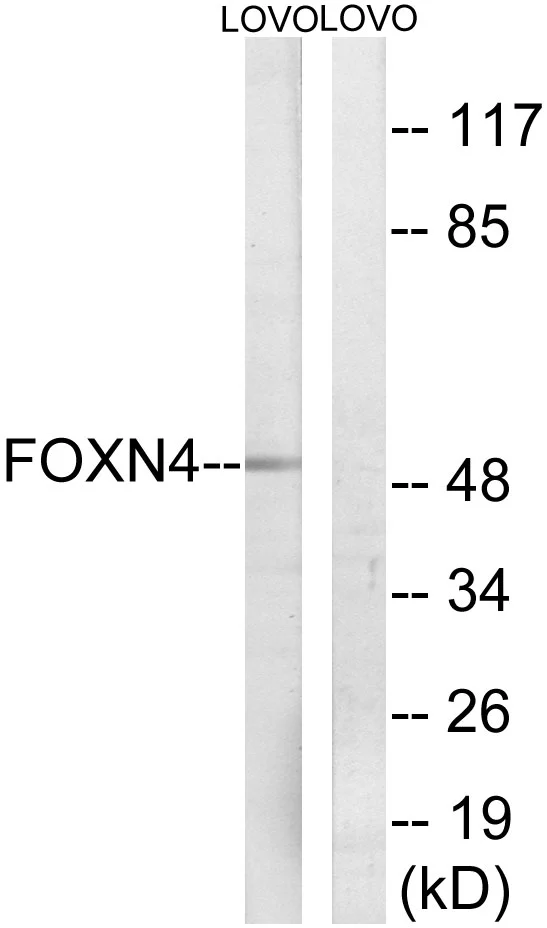 WB analysis of LOVO cell lysates using GTX87947 FOXN4 antibody. The lane on the right is blocked with the synthesized peptide. WB analysis of LOVO cell lysates using GTX87947 FOXN4 antibody. The lane on the right is blocked with the synthesized peptide.