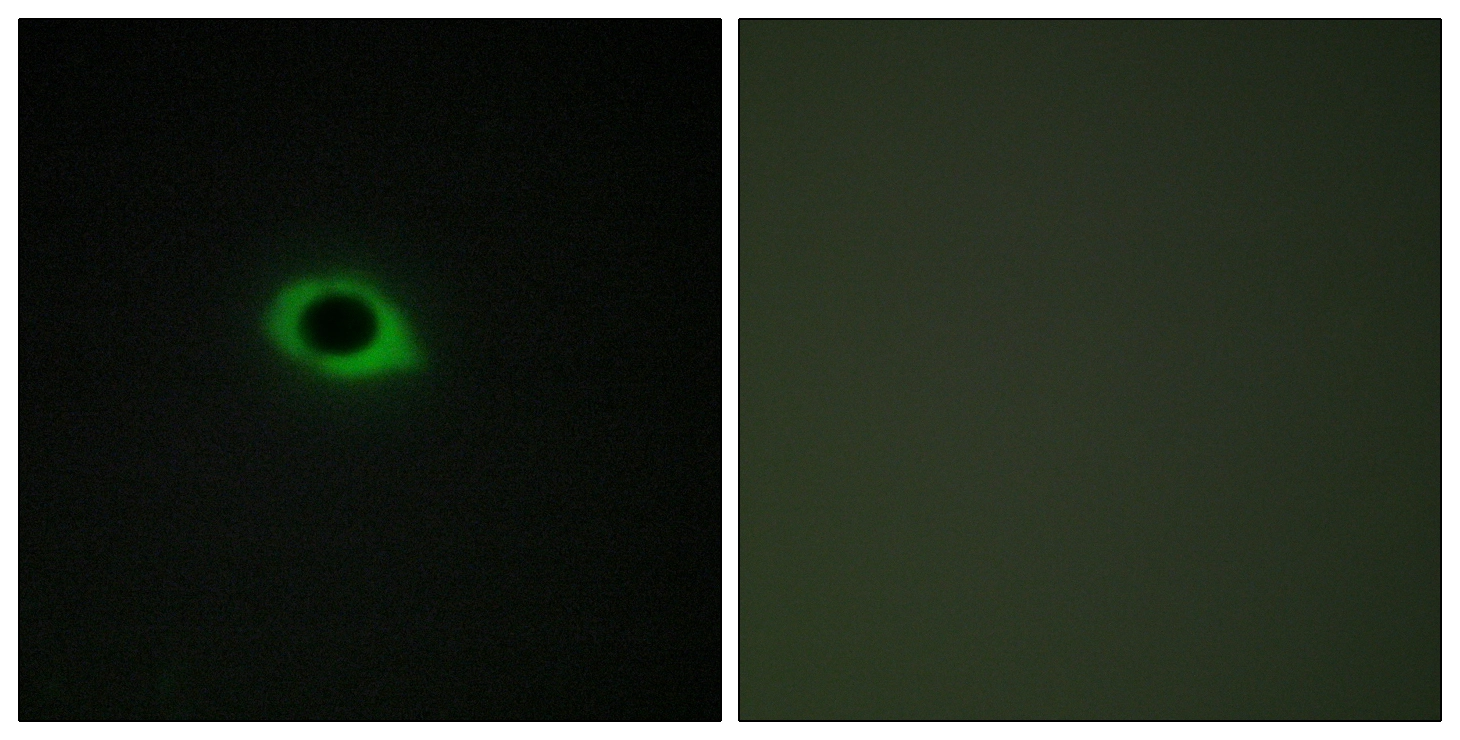IHC-P analysis of human heart tissue using GTX87949 TENS3 antibody. The picture on the right is blocked with the synthesized peptide.