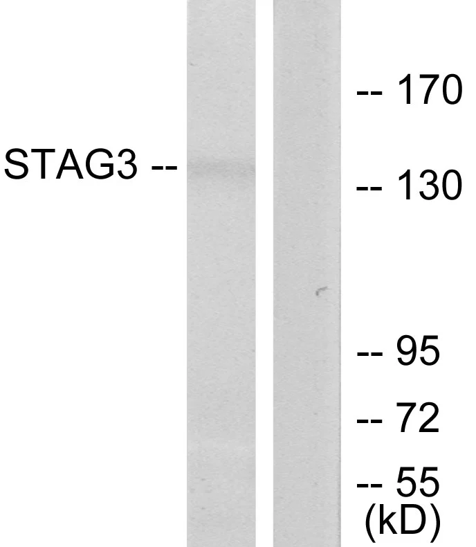 WB analysis of Jurkat cell lysates using GTX87952 SA3 antibody. The lane on the right is blocked with the synthesized peptide. WB analysis of Jurkat cell lysates using GTX87952 SA3 antibody. The lane on the right is blocked with the synthesized peptide.