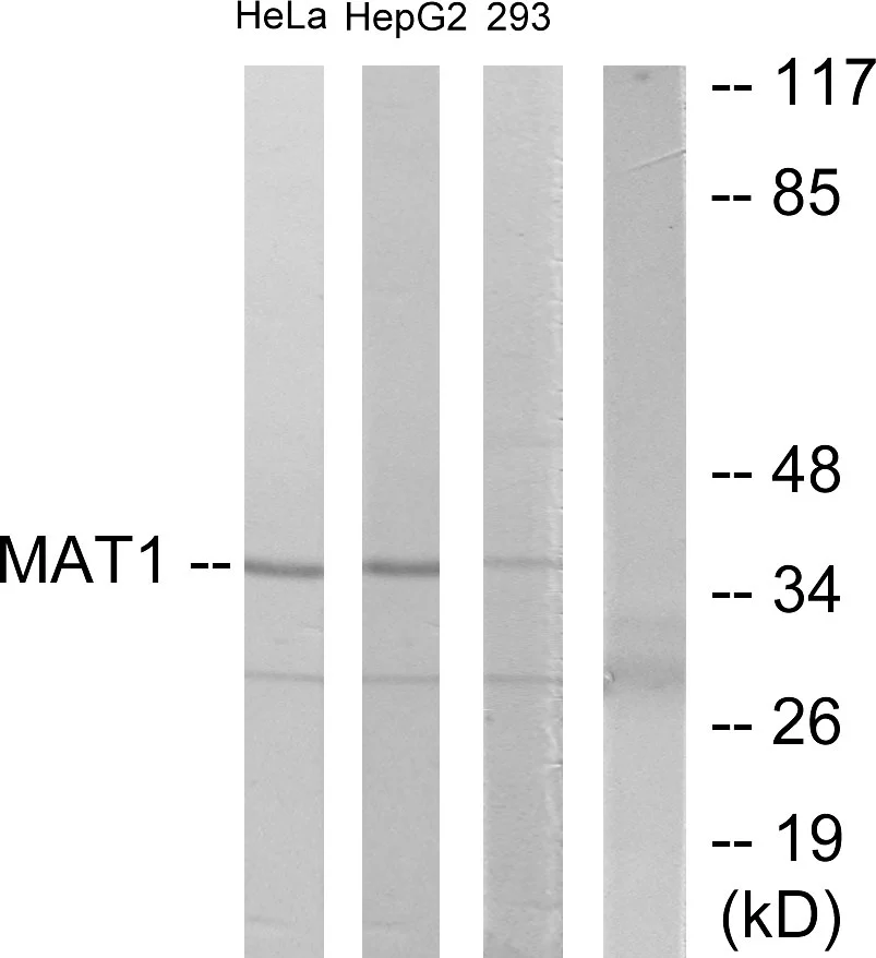 WB analysis of HeLa, HepG2, and 293 cell lysates using GTX87969 MNAT1 antibody. The lane on the right is blocked with the synthesized peptide. WB analysis of HeLa, HepG2, and 293 cell lysates using GTX87969 MNAT1 antibody. The lane on the right is blocked with the synthesized peptide.