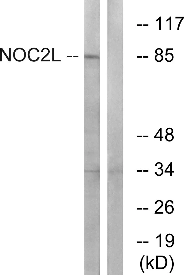 WB analysis of MCF-7 cell lysates using GTX87980 NOC2L antibody. The lane on the right is blocked with the synthesized peptide.