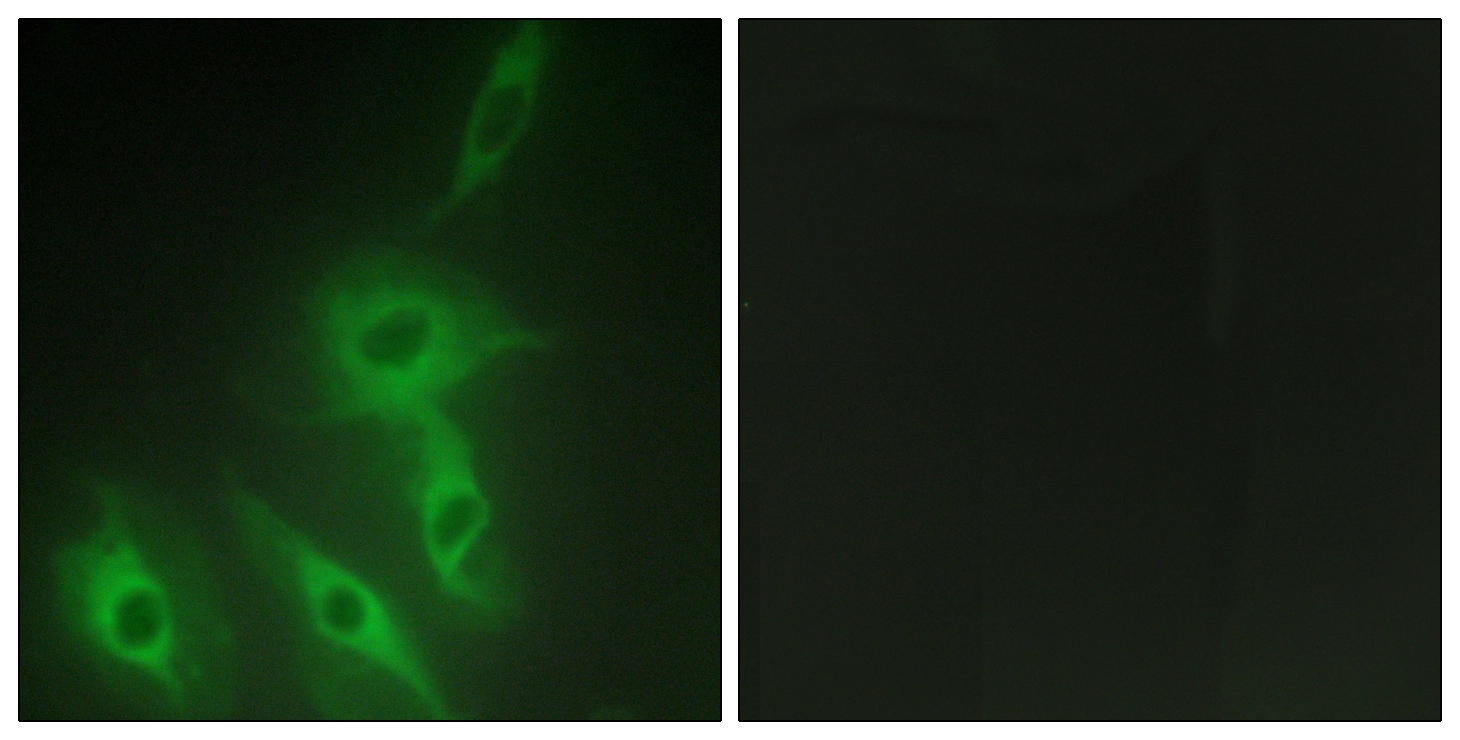 ICC/IF analysis of HeLa cells using GTX87983 AS250 antibody. The picture on the right is blocked with the synthesized peptide. ICC/IF analysis of HeLa cells using GTX87983 AS250 antibody. The picture on the right is blocked with the synthesized peptide.