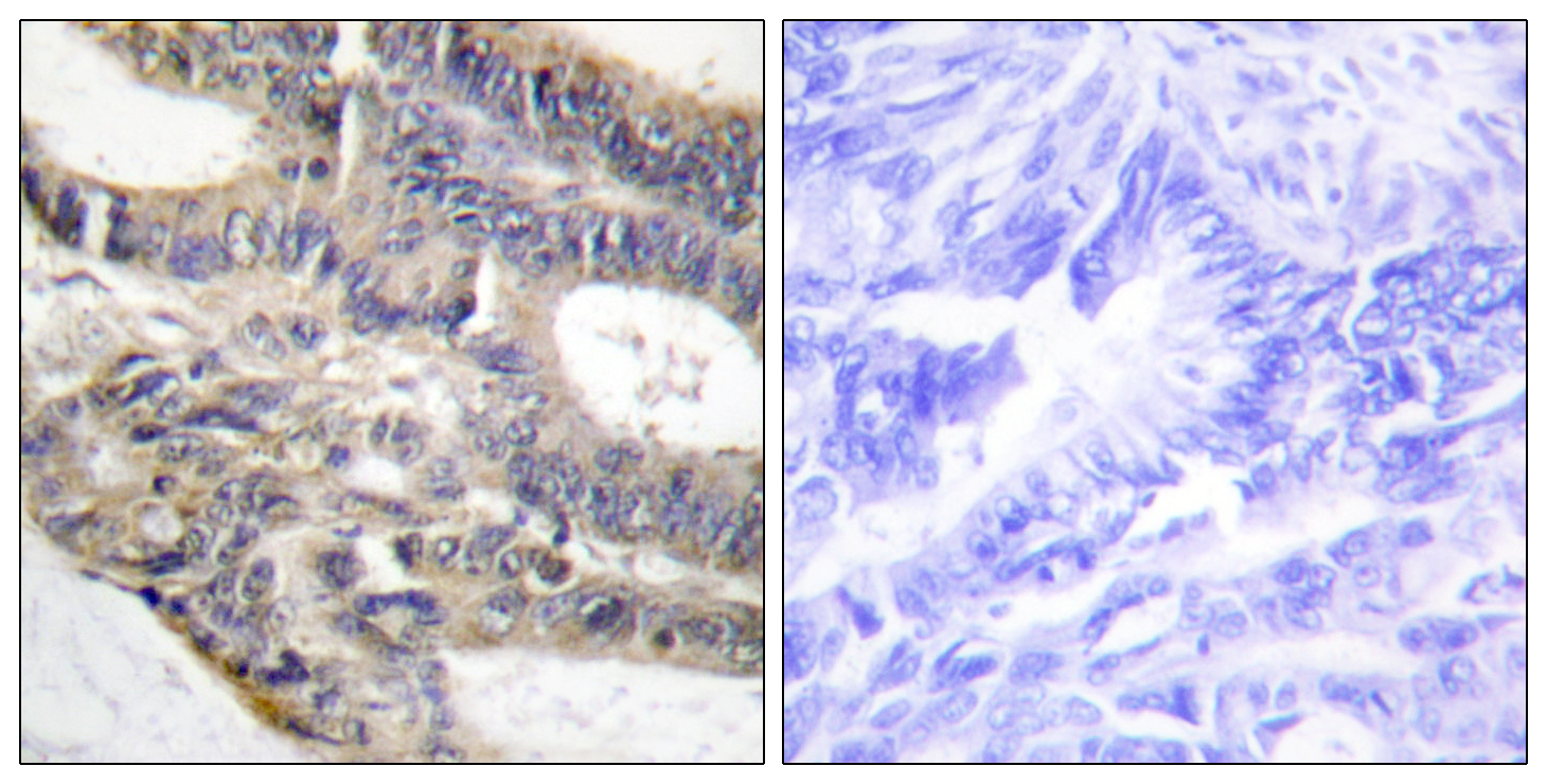 GTX87983 IHC-P Image