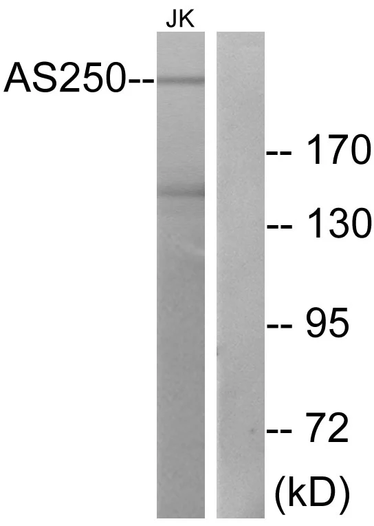 WB analysis of Jurkat cell lysates using GTX87983 AS250 antibody. The lane on the right is blocked with the synthesized peptide.