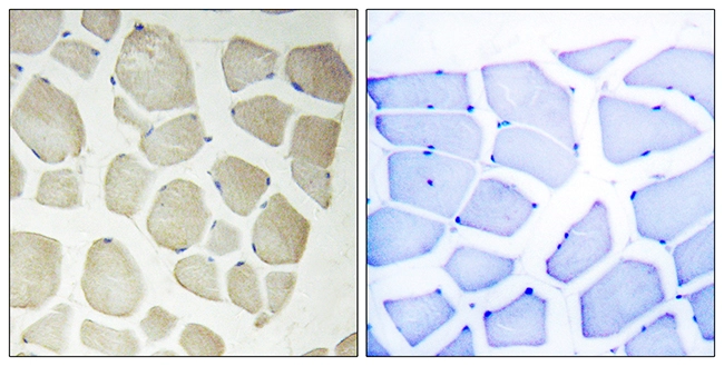 IHC-P analysis of human skeletal muscle tissue using GTX87990 NKIAMRE antibody. The picture on the right is blocked with the synthesized peptide. IHC-P analysis of human skeletal muscle tissue using GTX87990 NKIAMRE antibody. The picture on the right is blocked with the synthesized peptide.