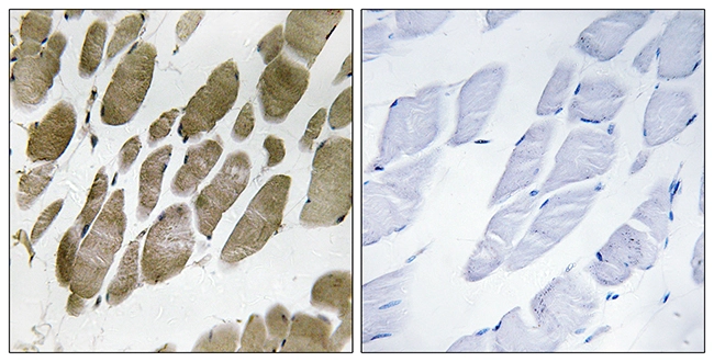 IHC-P analysis of human skeletal muscle tissue using GTX87991 NMU antibody. The picture on the right is blocked with the synthesized peptide. IHC-P analysis of human skeletal muscle tissue using GTX87991 NMU antibody. The picture on the right is blocked with the synthesized peptide.