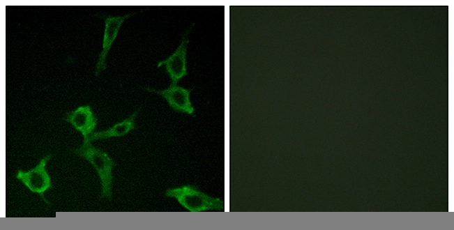ICC/IF analysis of LOVO cells using GTX87994 OR2AG1 + OR2AG2 antibody. The picture on the right is blocked with the synthesized peptide. ICC/IF analysis of LOVO cells using GTX87994 OR2AG1 + OR2AG2 antibody. The picture on the right is blocked with the synthesized peptide.