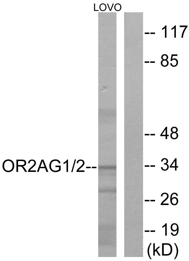 WB analysis of LOVO cell lysates using GTX87994 OR2AG1 + OR2AG2 antibody. The lane on the right is blocked with the synthesized peptide.