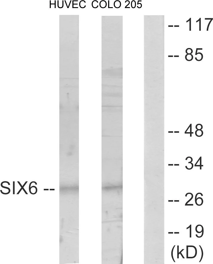WB analysis of HUVEC and COLO205 cell lysates using GTX87996 SIX6 antibody. The lane on the right is blocked with the synthesized peptide.
