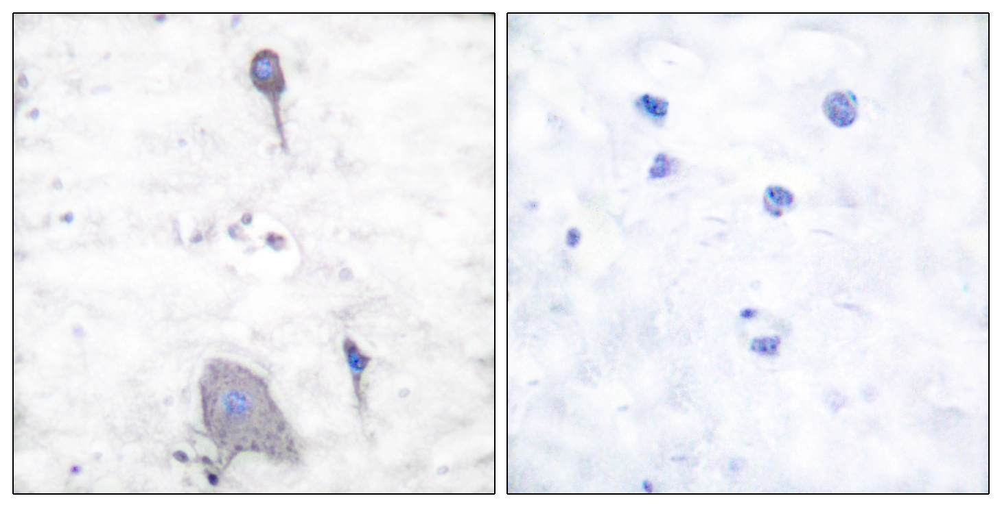 IHC-P analysis of human brain tissue using GTX87997 SIRP alpha antibody. The picture on the right is blocked with the synthesized peptide.
