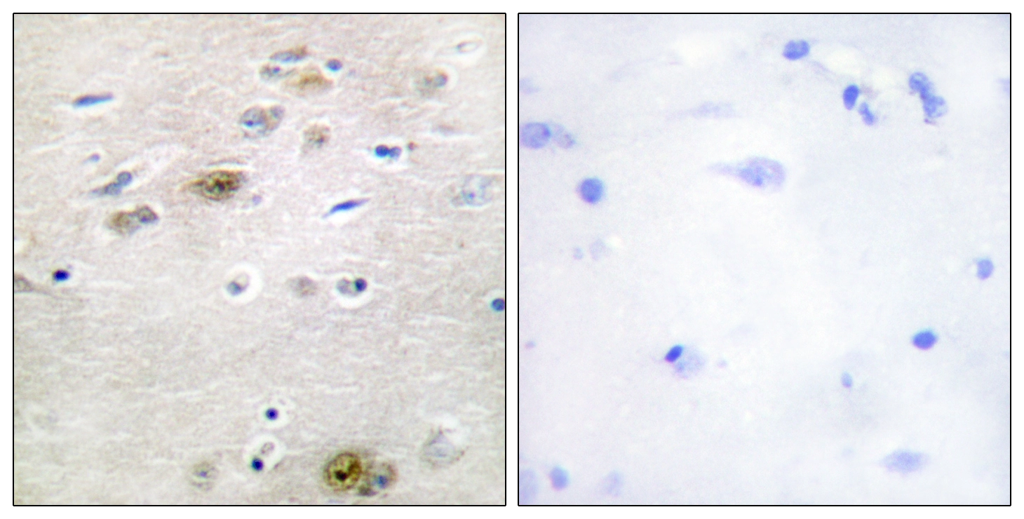 IHC-P analysis of human brain tissue using GTX87998 TRA-2 alpha antibody. The picture on the right is blocked with the synthesized peptide.