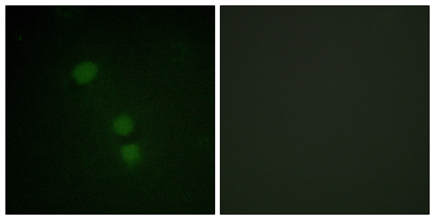 ICC/IF analysis of HeLa cells using GTX88002 Histone H2BK15ac (acetyl Lys15) antibody. The picture on the right is blocked with the synthesized peptide. ICC/IF analysis of HeLa cells using GTX88002 Histone H2BK15ac (acetyl Lys15) antibody. The picture on the right is blocked with the synthesized peptide.