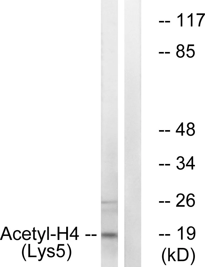 ICC/IF analysis of HeLa cells using GTX88005 Histone H4K5ac (acetyl Lys5) antibody. The picture on the right is blocked with the synthesized peptide.