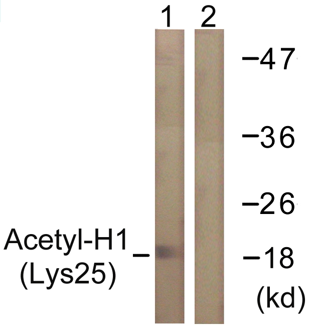 WB analysis of COS7 cells treated with TSA 400nM (24h) lysate using GTX88006 Histone H1K25ac (acetyl Lys25) antibody. The lane on the right is blocked with the synthesized peptide.