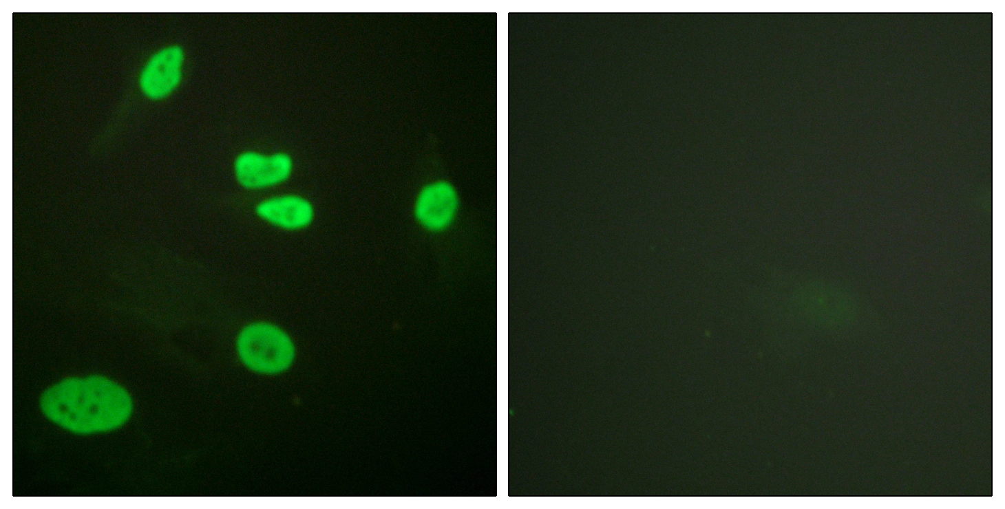 ICC/IF analysis of HeLa cells using GTX88007 Histone H3K9ac (Acetyl Lys9) antibody. The picture on the right is blocked with the synthesized peptide. ICC/IF analysis of HeLa cells using GTX88007 Histone H3K9ac (Acetyl Lys9) antibody. The picture on the right is blocked with the synthesized peptide.
