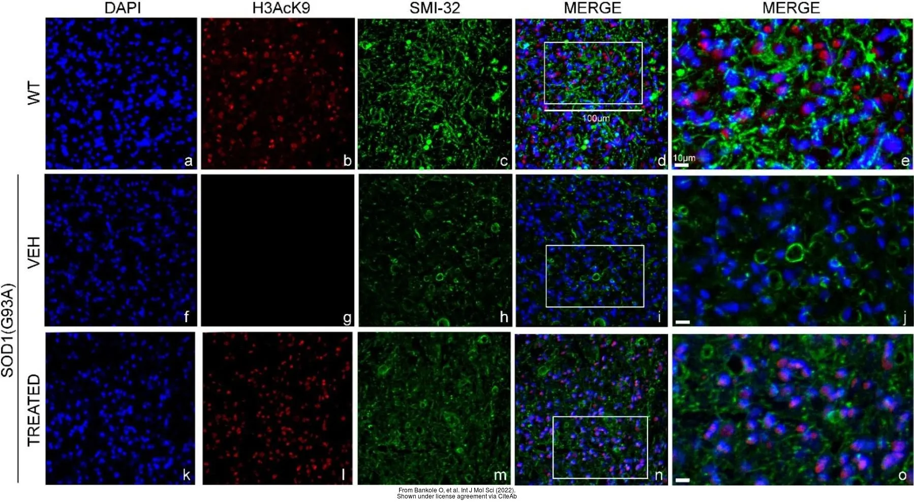 The data was published in the 2022 in Int J Mol Sci. PMID: 35162978