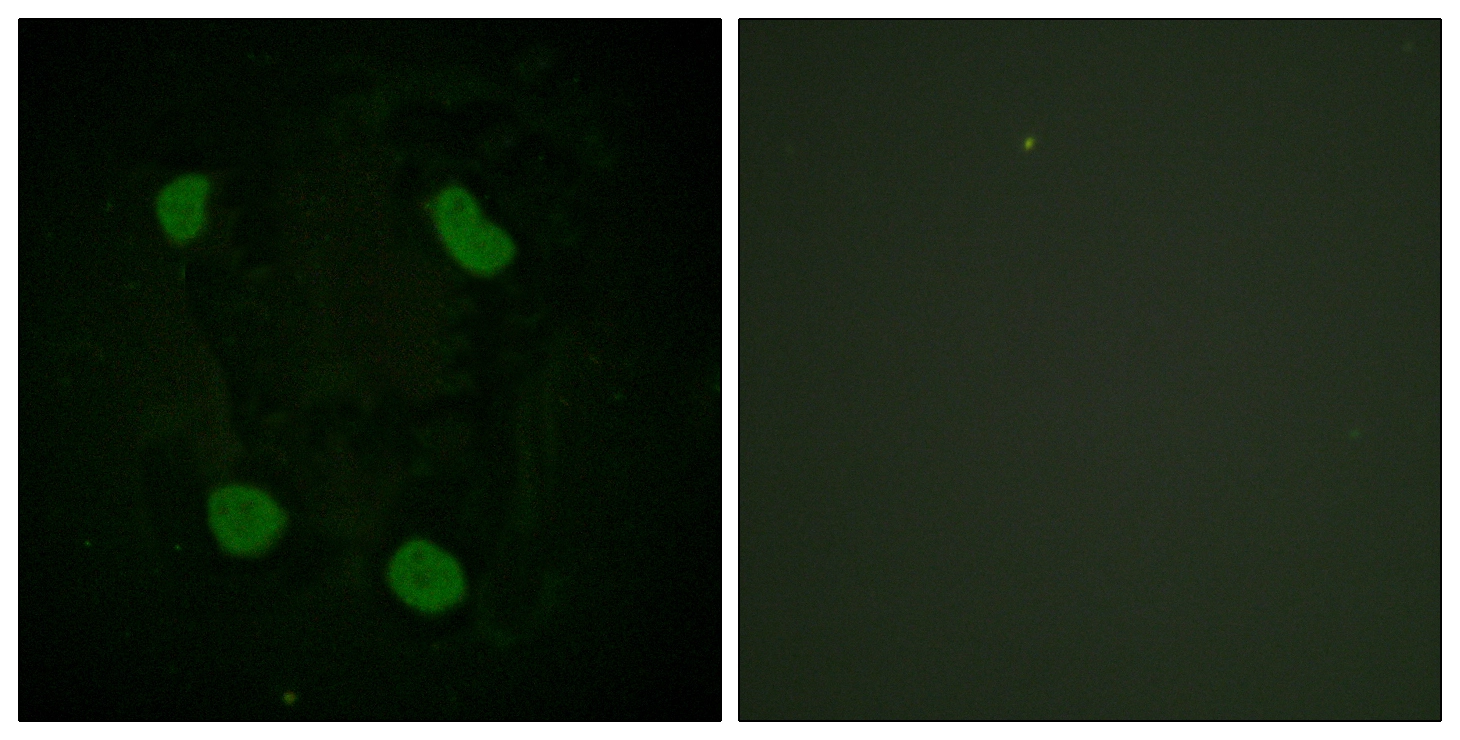 ICC/IF analysis of HeLa cells using GTX88008 Histone H3K14ac (Acetyl Lys14) antibody. The picture on the right is blocked with the synthesized peptide. ICC/IF analysis of HeLa cells using GTX88008 Histone H3K14ac (Acetyl Lys14) antibody. The picture on the right is blocked with the synthesized peptide.