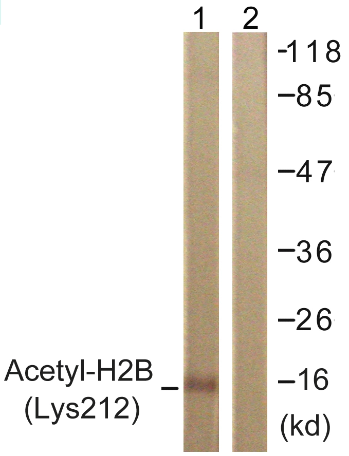 WB analysis of COS7 cells treated with TSA 400nM (24h) lysate using GTX88011 Histone H2BK12ac (acetyl Lys12) antibody. The lane on the right is blocked with the synthesized peptide.