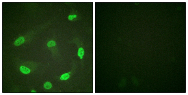 ICC/IF analysis of HeLa cells using GTX88013 p53 (acetyl Lys379) antibody. The picture on the right is blocked with the synthesized peptide. ICC/IF analysis of HeLa cells using GTX88013 p53 (acetyl Lys379) antibody. The picture on the right is blocked with the synthesized peptide.