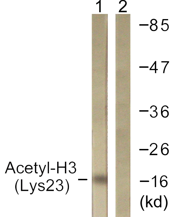WB analysis of Raw264.7 cells treated with TSA 400nM (24h) lysate using GTX88017 Histone H3K23ac (Acetyl Lys23) antibody. The lane on the right is blocked with the synthesized peptide.